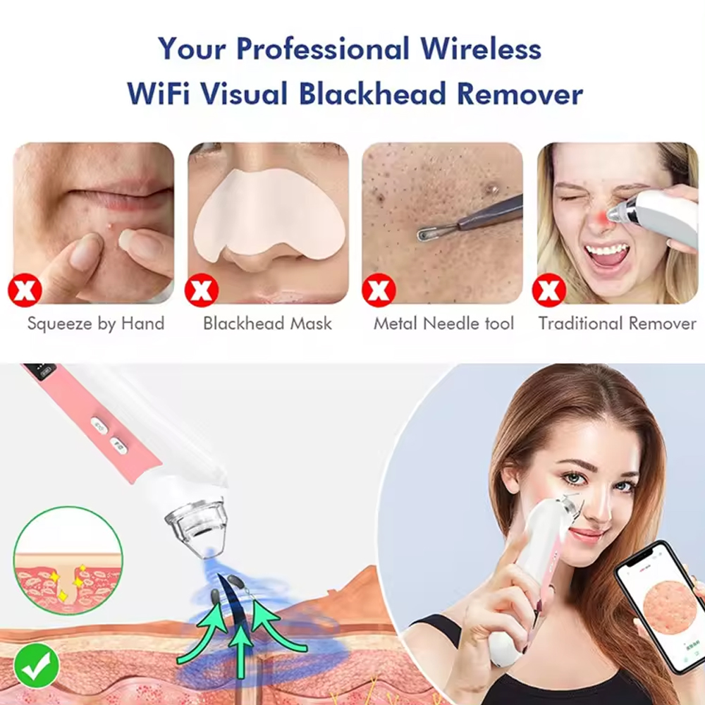 카메라 포함 6 헤드 모공 클리너, 블랙헤드 리무버,  - Nasal Aspirator 리뷰 및 가격